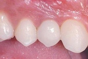 AfterPic4-5b33cbaf39cf5