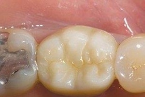 AfterPic5-5b33cbb0c918c