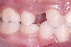 BeforePic4-5b33cbbb79411