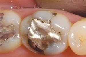 BeforePic5-5b33cbbd43356