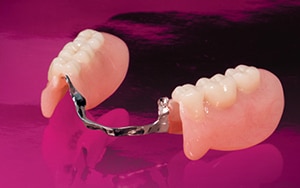 denturespic2