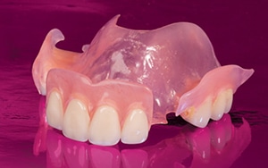 denturespic3