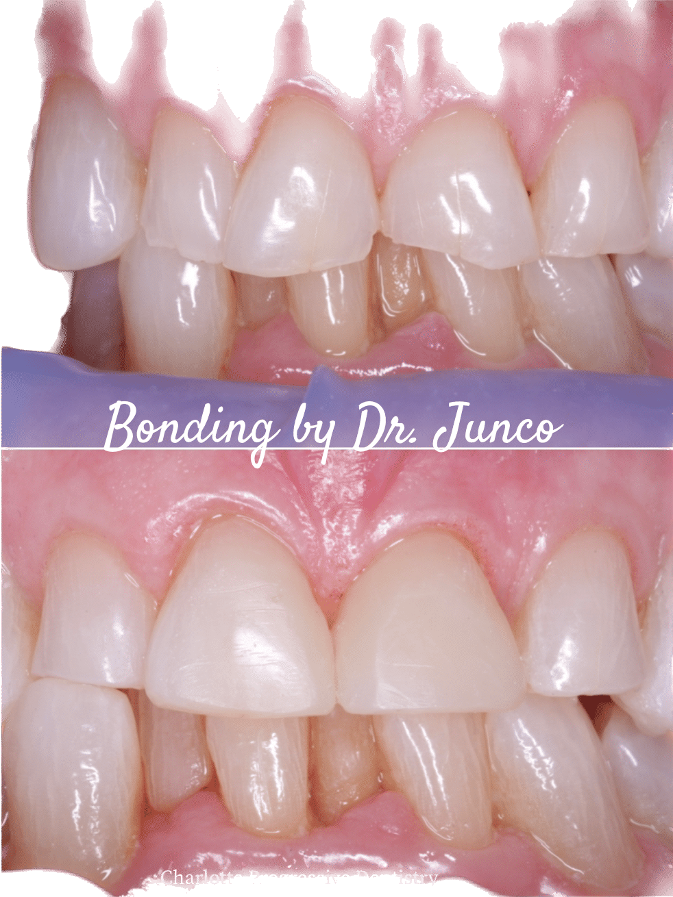 Cosmetic Dentistry Procedures Cosmetic Dental Services