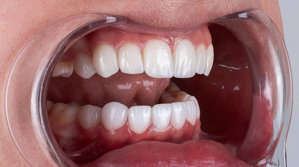 Cosmetic Dentist Charlotte